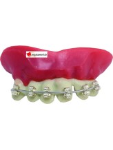 Dentier appareil dentaire avec pâte Dentier appareil dentaire avec pâte