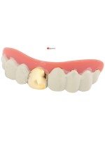 Denture with a gold tooth and paste