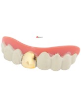 Denture with a gold tooth and paste Denture with a gold tooth and paste